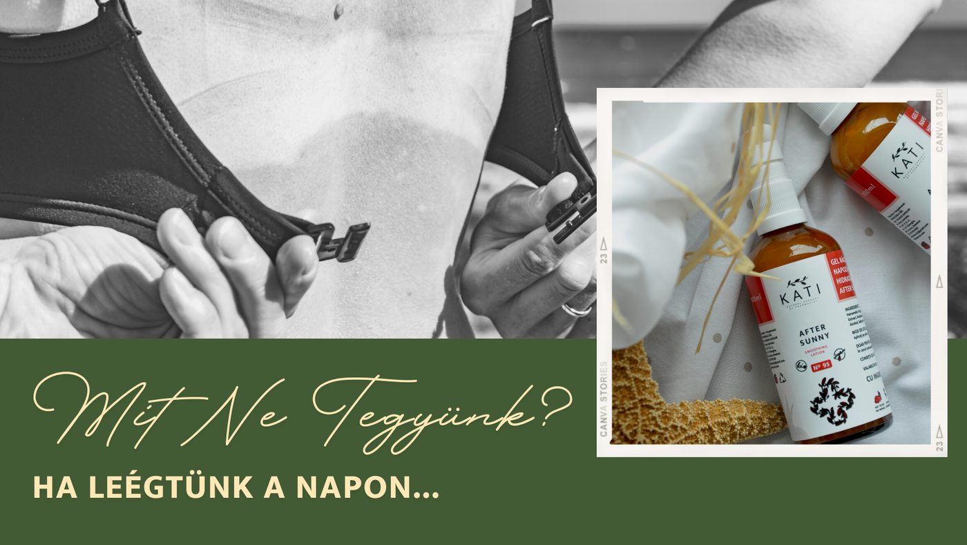 Mit NE tegyünk, ha leégtünk a napon?